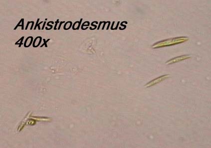 Ankistrodesmus - needle or spindle-shaped cells that may occur individually or in aggregations (400x)