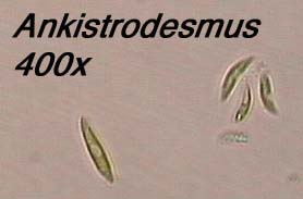 Ankistrodesmus - needle or spndle-shaped cells may occur singly or in aggregations (400x)