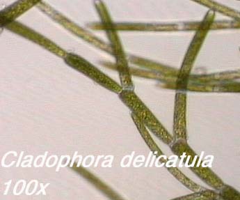 Cladophora delicatula (100x)