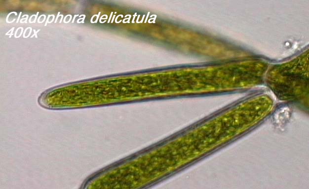 Cladophora delicatula (400x)