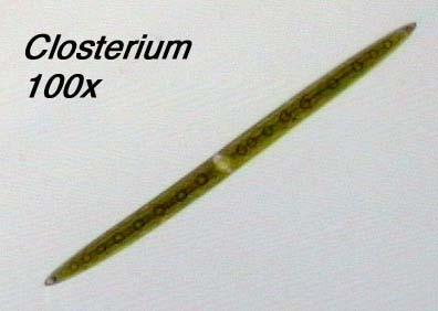 Closterium (100x)