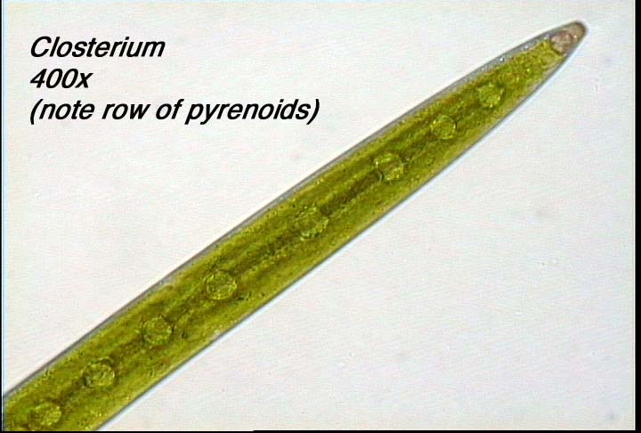 Closterium (400x) - note row of pyrenoids