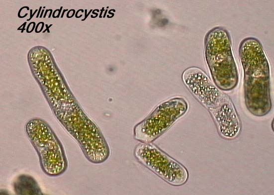 Cylindrocystis (400x)