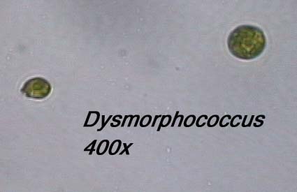 Dysmorphococcus (400x)