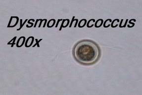 Dysmorphococcus (400x)