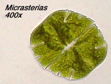 Micrasterias (400x)