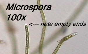 Microspora (100x) - not empty filament ends