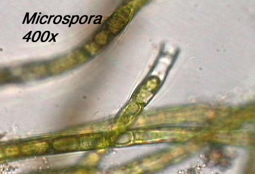 Microspora (400x)