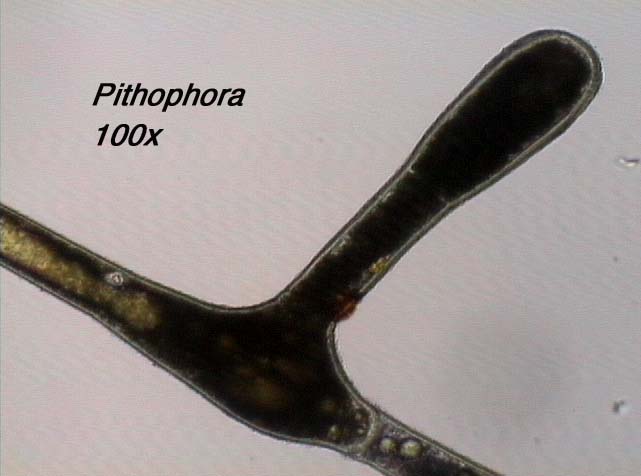 Pithophora (100x)