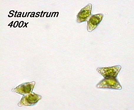 Staurastrum (400x)