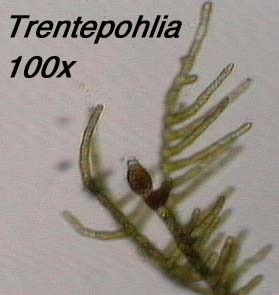 Trentepohlia (100x)