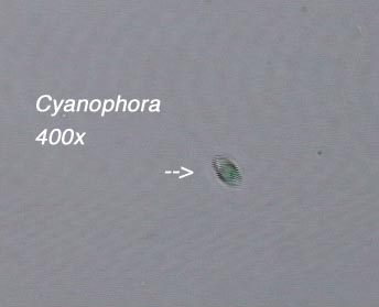 Cyanophora (400x)