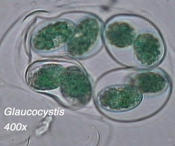 Glaucocystis (400x)