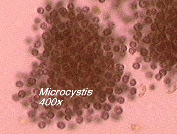 Microcystis (400x)