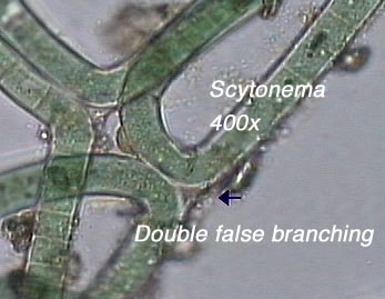 Scytonema (400x) - note double false branching