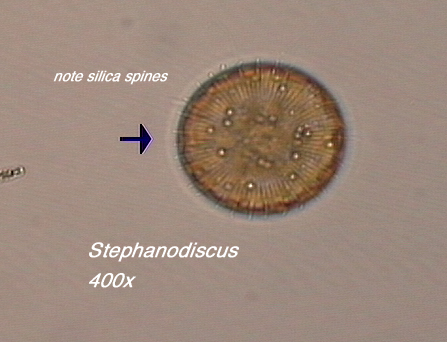 Stephanodiscus (400x) - note silics spines in valve view