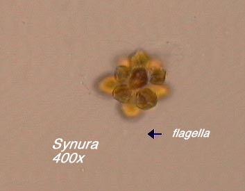 Synura (400x) - note flagella