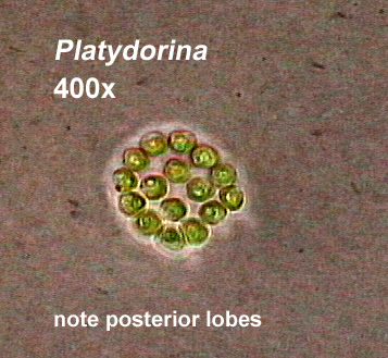 Platydorina (400x, india ink prep) - note posterior lobes