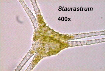 Staurastrum (400x)