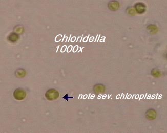 Chloridella (1000x) - a small spherical Tribophycean (Ochrophyta) unicell with several chloroplasts.