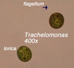 Trachelomonas (400x) - note lorica and flagellum